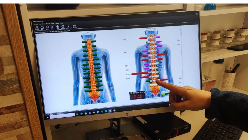 Evaluación termográfica digital de la columna en Solana Chiropractic, Eixample Barcelona.